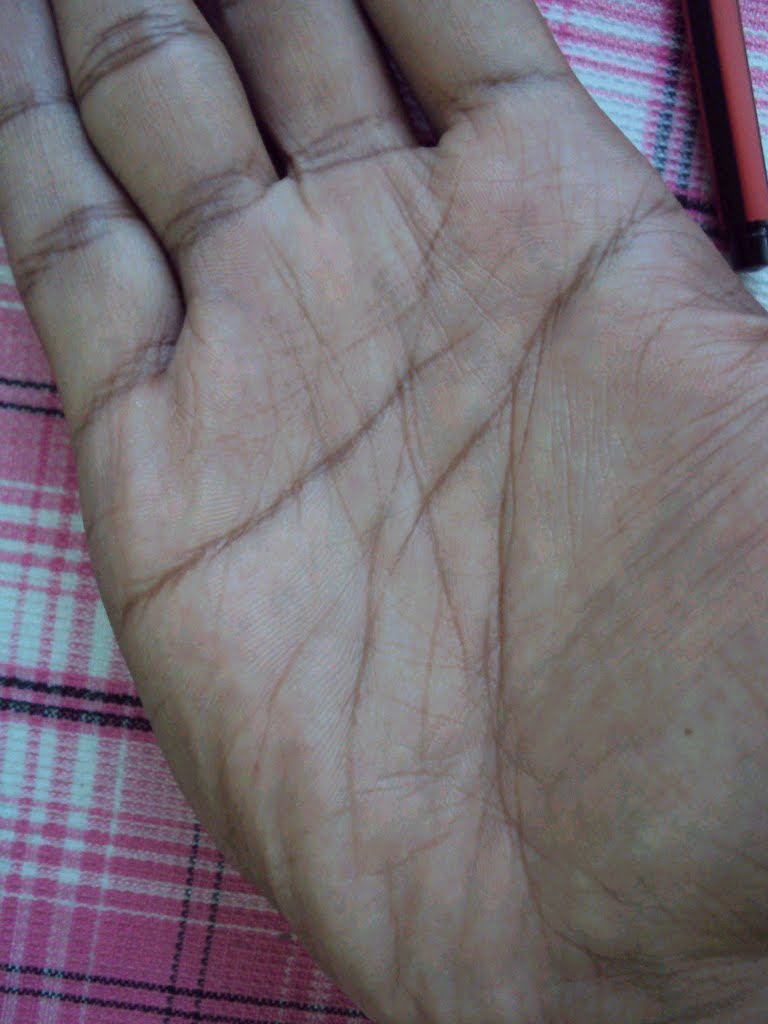 Very Poor Life Line On Hand Palmistry ~ INDIAN PALM READING | HAST