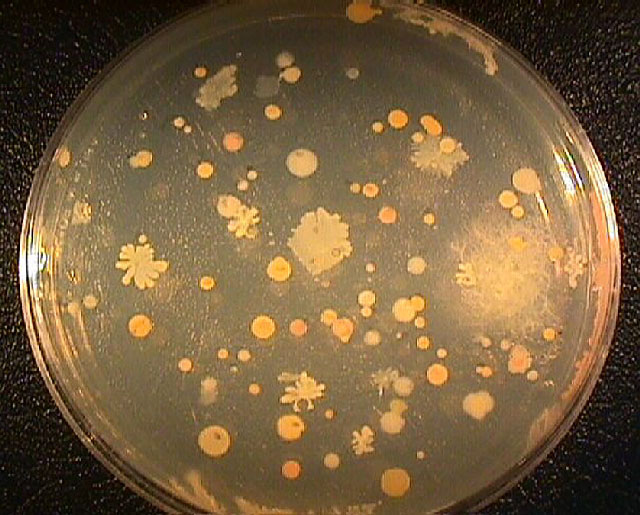Желтые бактерии. Колонии бактерий в чашке Петри. КМАФАНМ на чашках Петри. Желтые колонии на чашки Петри что это. Актиномицеты Петри.