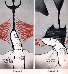 How Can Guys Tell If You'Re A Virgin By Looking At The Vagina 17