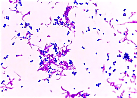 lab report on staphylococcus aureus after acid fast staining In this specimen, the gram-positive bacterium staphylococcus aureus retains crystal violet dye even after the decolorizing agent is added acid-fast staining is another commonly used, differential staining technique that can be an additionally, this species has not been successfully cultured in the laboratory on an. lab report on staphylococcus aureus after acid fast staining In this specimen, the gram-positive bacterium staphylococcus aureus retains crystal violet dye even after the decolorizing agent is added acid-fast staining is another commonly used, differential staining technique that can be an additionally, this species has not been successfully cultured in the laboratory on an.