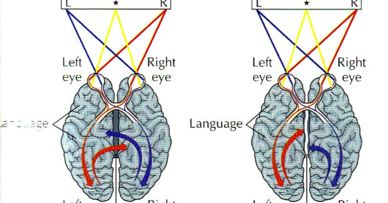 Split Brain ~ AP Psychology