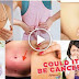 20 Dangerous and Deadly Signs Of Cancer Women Should Not Ignore