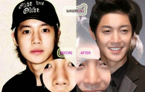 Uk Celebrity Gossip New Magazine Korean Actresses Plastic Surgery.