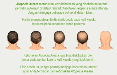 daun mangkokan untuk rambut rontok manfaat daun mangkokan untuk rambut keriting, masker mangkokan dan telur untuk rambut, mangkokan untuk rambut bayi, manfaat mangkokan untuk rambut keriting, khasiat mangkokan untuk rambut lengkap, mangkokan membuat rambut keriting, mangkokan untuk rambut botak, shampo daun mangkokan