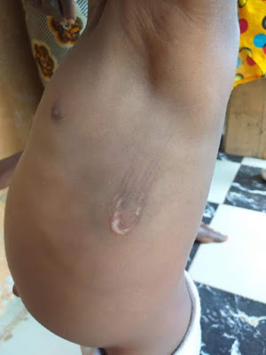 Two children, aged 3 and 4 tortured and starved by their aunt in Edo