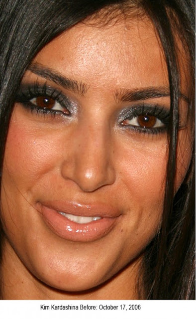 kim+kardashian+before+plastic+surgery.jp