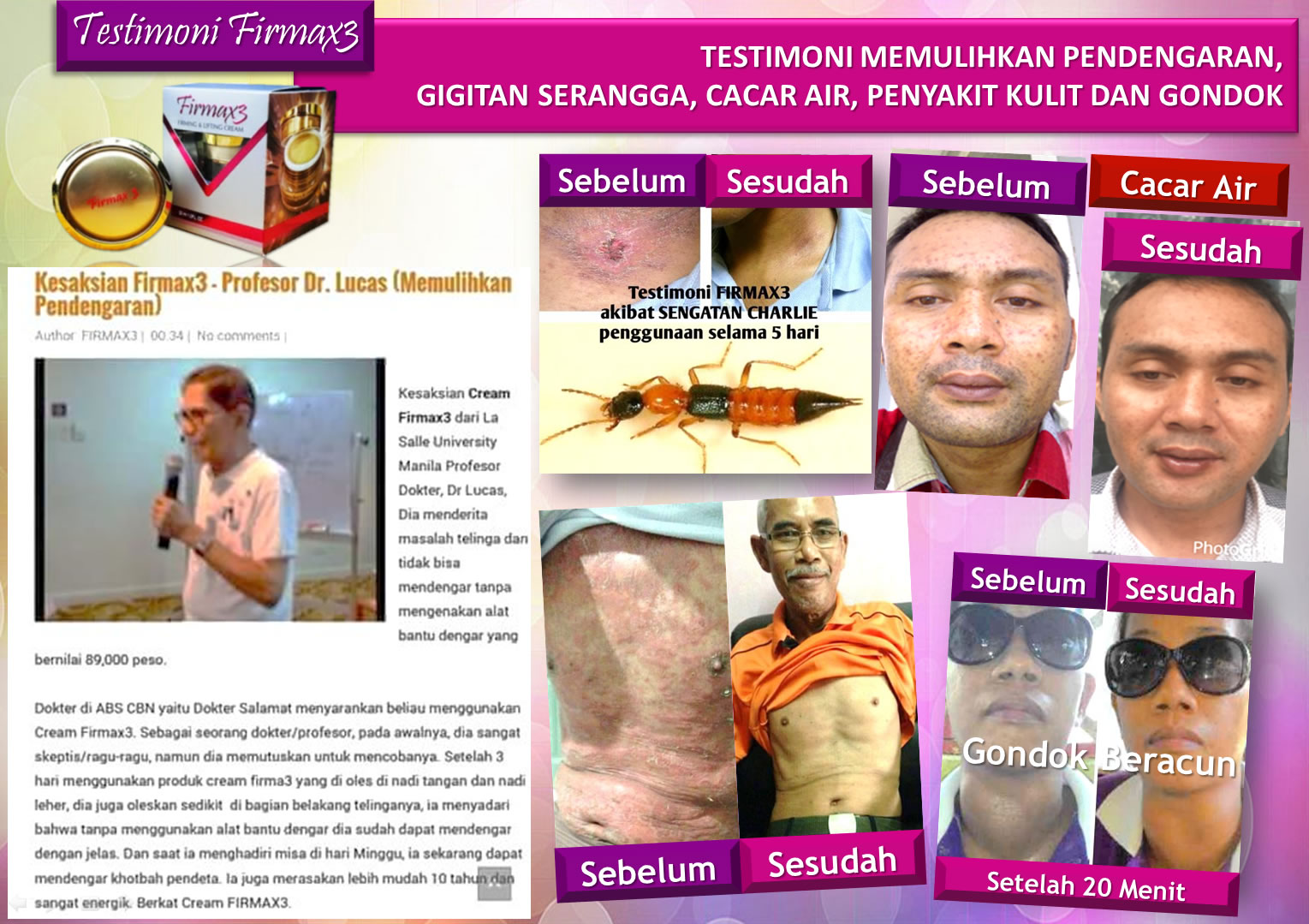 Testimoni Firmax3 Cream Indonesia