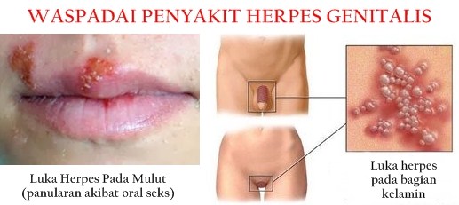 https://1.bp.blogspot.com/-blcqmjG06T0/WJFf0ynAmzI/AAAAAAAAAT8/Mkv9QyHI87MryRBPQ_FcFChEPfvlqywLACLcB/s1600/infeccion.jpg