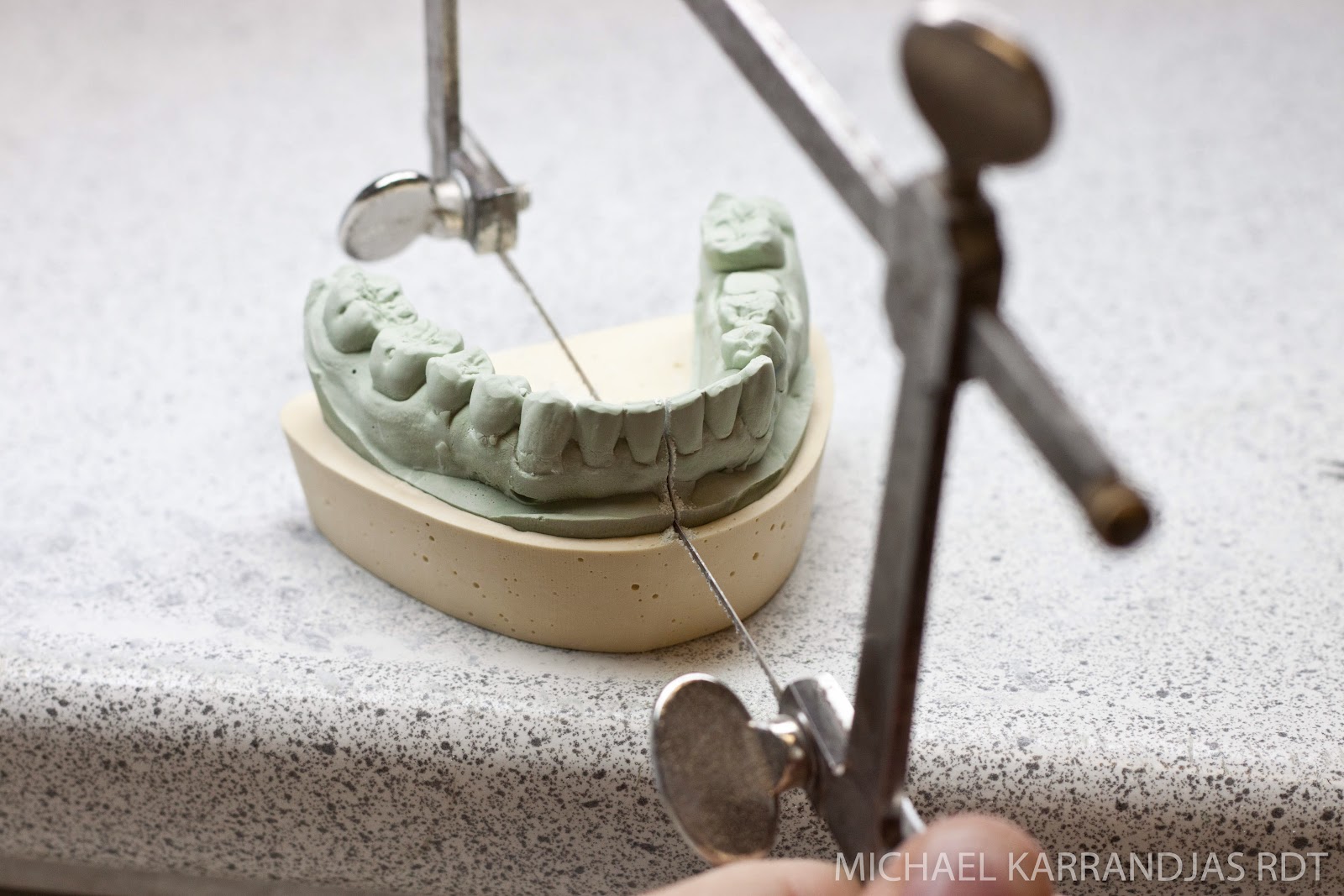 Dental Lab Model Fabrication | Making Noise And Drinking Beer