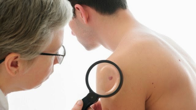 How To Recognize Skin Cancer – This Could Save Your Life!