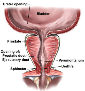 prostate cancer symptoms forum