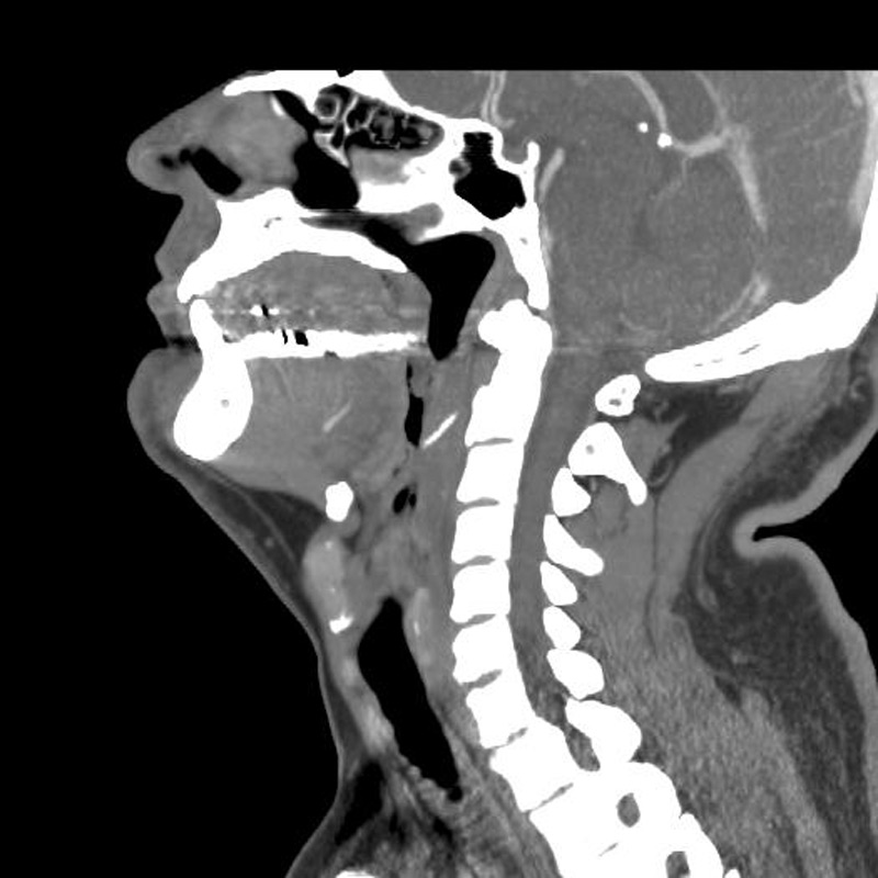 Radiología de la cara y el cuello: CARA Y CUELLO. GENERALIDADES