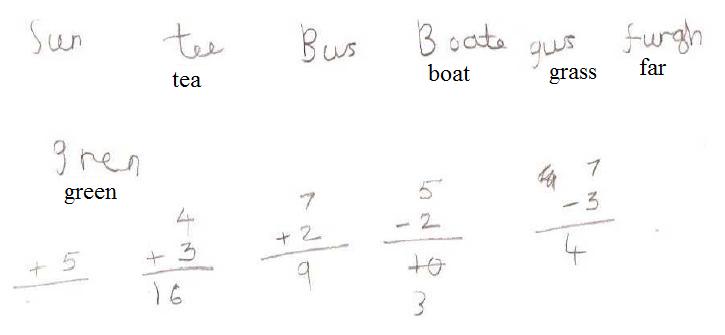 Dyscalculia treatment picture