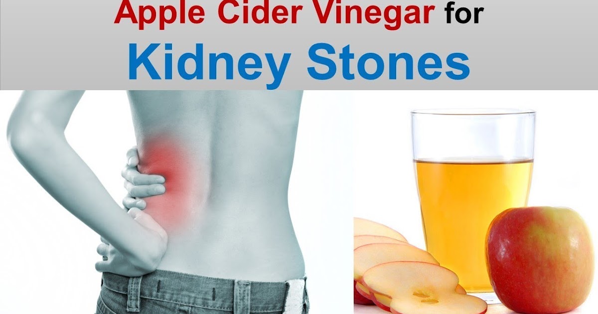 Mix A Lemon, Olive Oil And Vinegar To Dissolve Kidney Stones