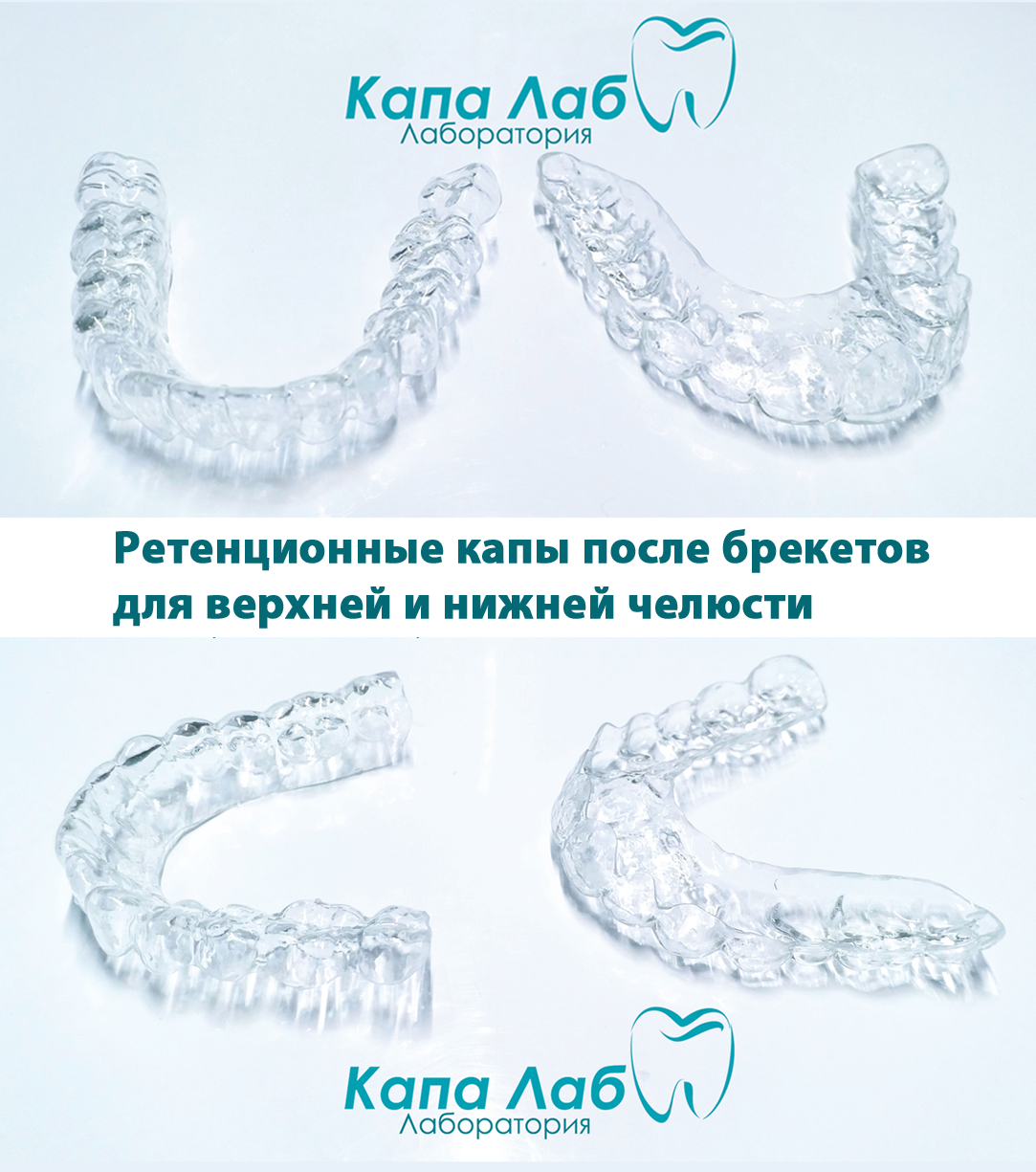 Невидимые брекеты элайнеры. Каппы инвизилайн. Ретенционная капа после брекетов. Капы для выравнивания зубов. Капа для зубов стоматологическая.
