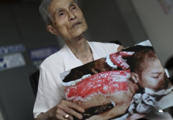 Selamat dari Bom Nagasaki, Pria ini Masih Terus Merasakan Sakit