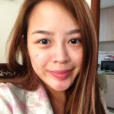 acne recovery roaccutane singapore acne recovery roaccutane singapore