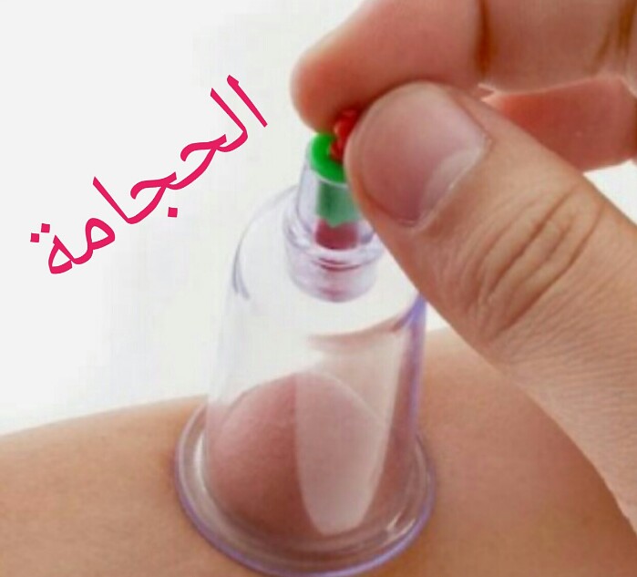 التداوي بالحجامه.أهمية الحجامة. أحاديث نبوية عن الحجامه.