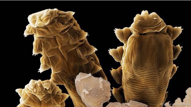 demodex folliculorum toma de muestra