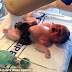 Photos: Miracle baby born with intestines and bladder outside his body