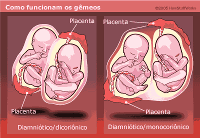 Vida de Mãe de Gêmeos: Univitelinos ou Bivitelinos