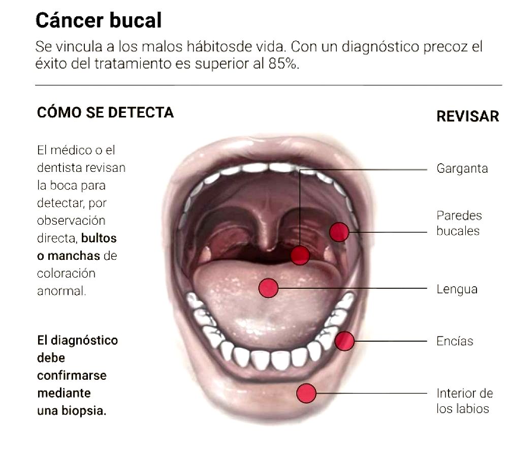 cancer bucal informacion)