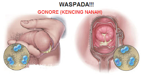 Berapa Harga Obat Kencing Nanah Gangjie Ghosiah Di Banjarbaru Banjarbaru