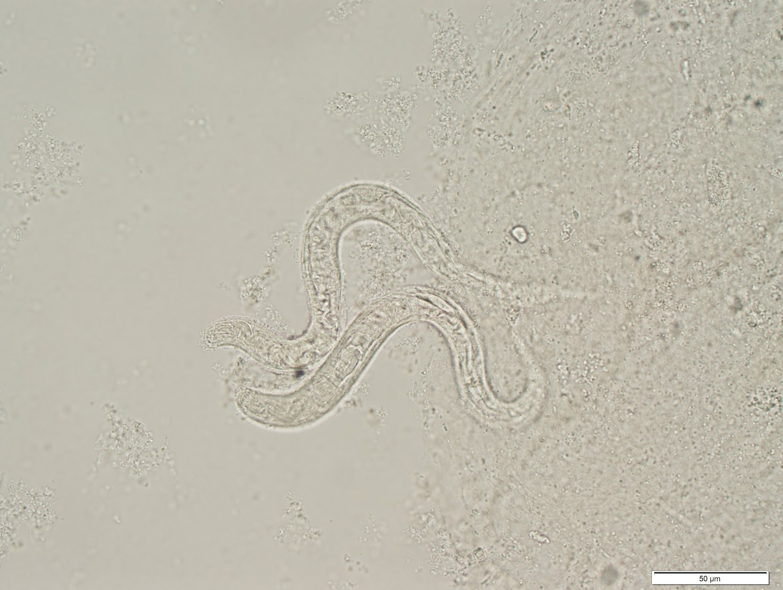 Creepy Dreadful Wonderful Parasites Case Of The Week 266