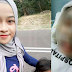 Tiba-tiba pitam, wajah melecur 100% akibat tersembam dalam minyak panas
