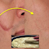 Naturally Remedies: Remove Your Scars Permanently By Putting This Cream On Top
