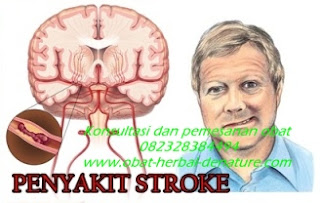 obat stroke herbal,obat herbal stroke,obat stroke denature,obat lumpuh separo,obat stroke ringan,obat stroke berat