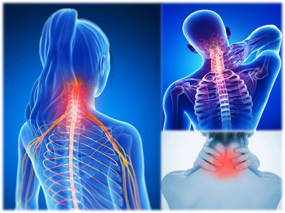 Resultado de imagen para DOLOR CERVICAL