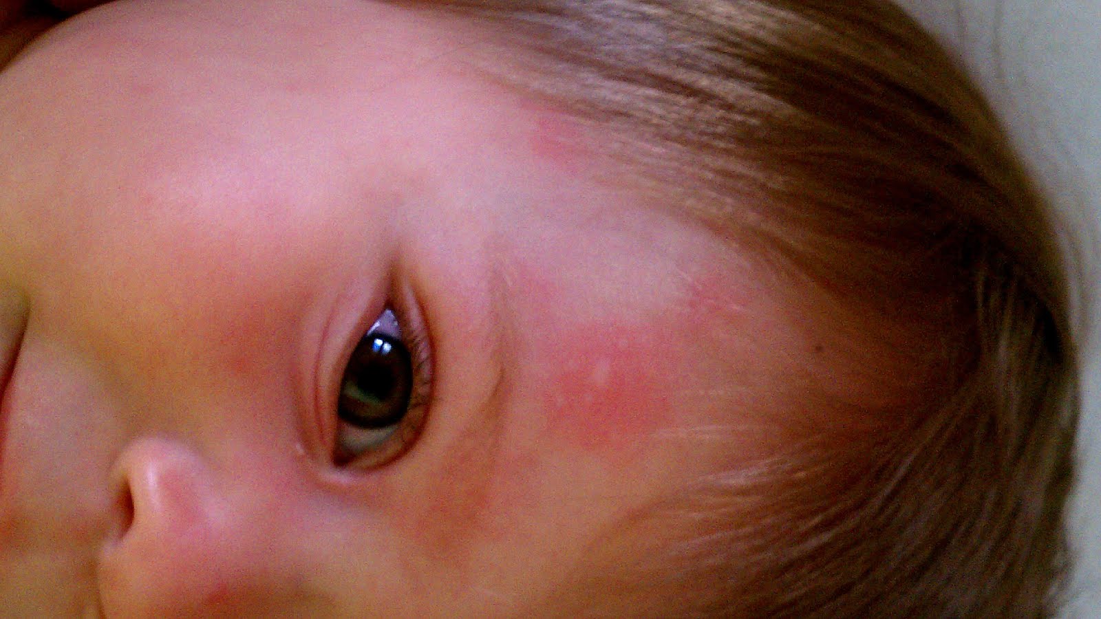 Allergy To Cats Cat Choices