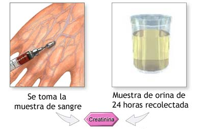 para que es el examen de urea y creatinina