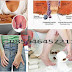 Obat Manjur Buat Obati Wasir (Hemoroid) Parah thumbnail
