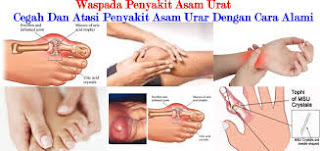 Image Nama Obat Asam Urat Tradisional Paling Tokcer