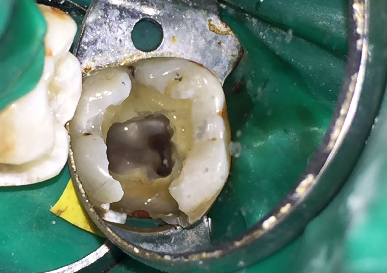 Caso clínico Master: Itsmos para todos