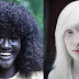 7 Gadis Cantik yang Berkulit Super Aneh