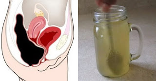 Mix Honey And Apple Cider Vinegar To Clear Your Colon Of Toxins