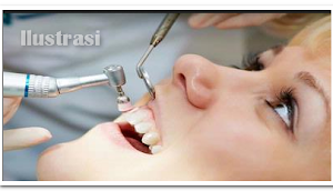 Hati-hati...!!! Salah Membersihkan Gigi Bisa Sebabkan Infeksi Berbahaya