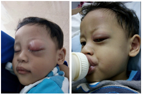obat tumor obat tumor