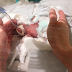 The Tiniest Surviving Premature Baby In The World Has Been Finally Sent Home After Months In The Hospital