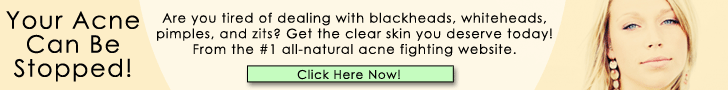 Acne Free