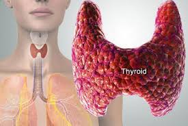 Obat kelenjar tiroid membengkak