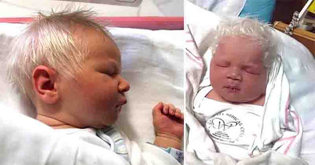 An Adorable Angel Was Born With Pristine White Hair And His Parents Were Anxious Until They Got The Diagnosis Of The Doctors! Know The Mystery Behind This Little Angel!