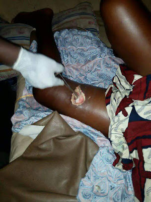  Update: The 16-year-old girl stabbed by a young man in Delta State because she rejected him, is dead (photos)