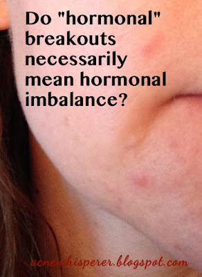 Your acne breakouts do not necessarily reflect a hormonal imbalance in your body