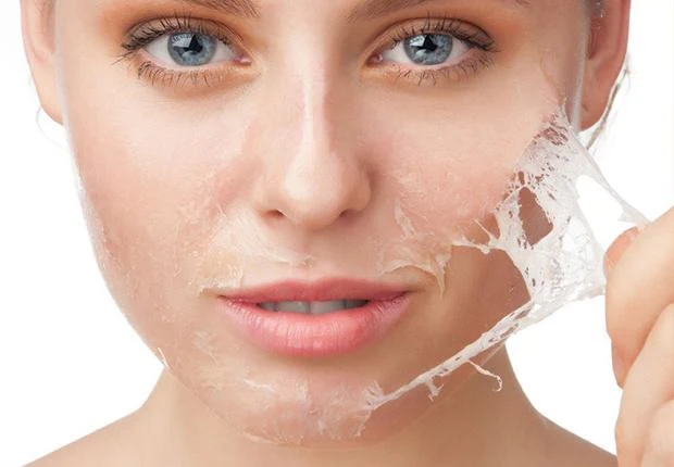 Atasi Masalah Kulit Berjerawat Dengan Tera Skincare