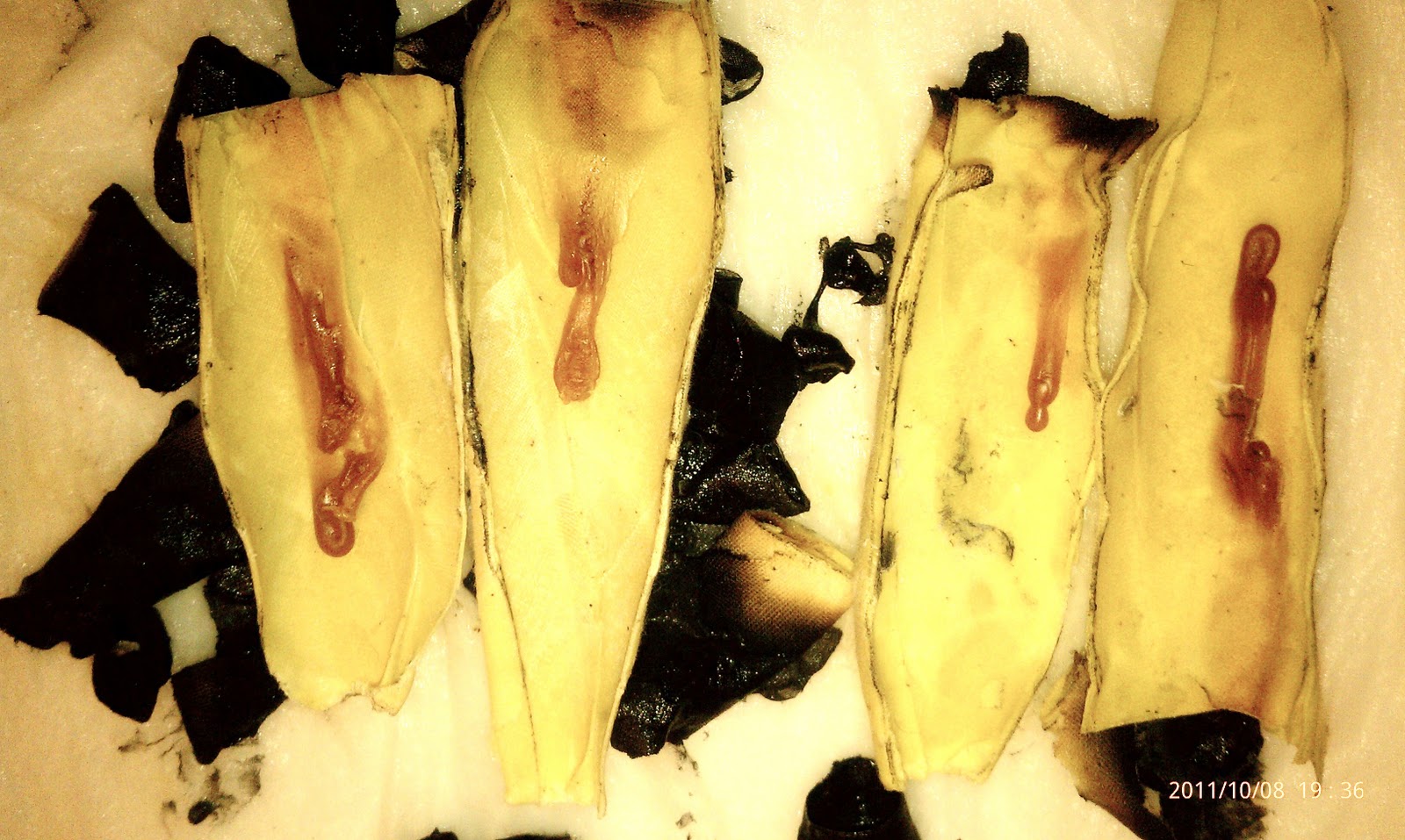 Unique Healings Ear Candling!