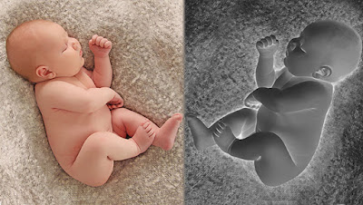 dos fotos de un bebe, una normal y la otra en negativo